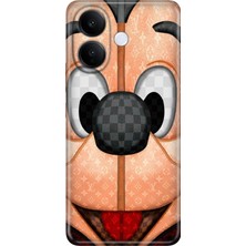 Vivo V60 Lite 5g Kılıf Desenli Baskılı Tpu Rubber Kapak Lv-Mickey