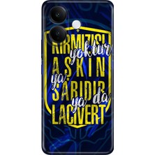 Nurdic Vivo V60 Lite 5g Kılıf 0.4mm Lazer Kesim Silikon Kapak Aşkın Rengi Sarı Lacivert
