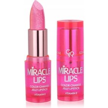 Misda Store Rose Miracle Lips Color Change Jelly Lipstick No: 101 Berry Pink - Renk Değiştiren Ruj