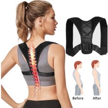 Allians Dik Durmayı Destekleyen Ortopedik Bel ve Omuz Korsesi Aparatı