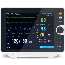 Allians Yüksek Çözünürlüklü 15.6" Monitör, Geniş Ekran, Güçlü Görüntü Kalitesi