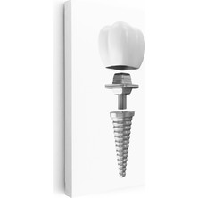 Kanvas Tablo Dental Implant Parçaları Diş Hekimi Tablosu Ev Ofis Duvar Dekoru