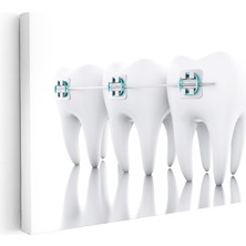 Kanvas Tablo Sıralı Diş Modeli ve Teller Diş Hekimi Tablosu Ev Ofis Duvar Dekoru