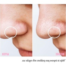 MarkEntegra Bha Içerikli Gözenek Sıkılaştırıcı Arındırıcı Tonik - 250 ml