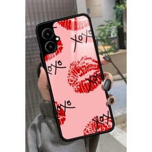 Snacase Omix X5 Uyumlu Dudak Tasarımlı Parlak Silikon Kılıf