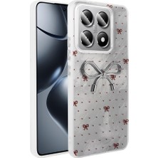 FLAMENKO 14T Pro Kılıf Kamera Korumalı Figürlü Flmk Ponti Silikon Kapak - Açık Mavi