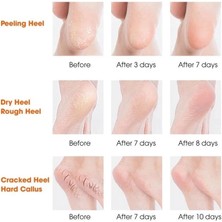 Silikon Topuk Nemlendirici Çorap - Lisinya