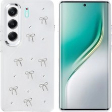 Roketcim Tecno Camon 40 4g Kılıf Airbag Tasarımlı Simli Şeffaf Kutup Kapak