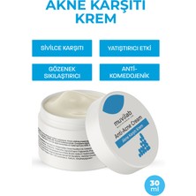 Akne Sivilce Gözenek Siyah Nokta Karşıtı Krem Yağlı Karma Ciltler Için Nemlendirici Leke Karşıtı
