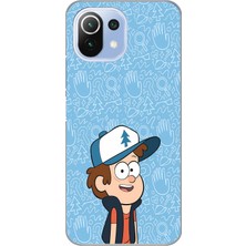 Mobilpad Xiaomi Mi 11 Lite Uyumlu Baskılı Yumuşak Silikon Şeffaf Telefon Kılıfı