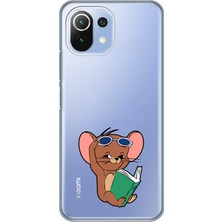 Mobilpad Xiaomi Mi 11 Lite Uyumlu Baskılı Yumuşak Silikon Şeffaf Telefon Kılıfı