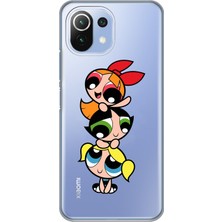 Mobilpad Xiaomi Mi 11 Lite Uyumlu Baskılı Yumuşak Silikon Şeffaf Telefon Kılıfı