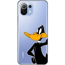 Mobilpad Xiaomi Mi 11 Lite Uyumlu Baskılı Yumuşak Silikon Şeffaf Telefon Kılıfı