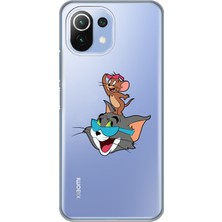 Mobilpad Xiaomi Mi 11 Lite Uyumlu Baskılı Yumuşak Silikon Şeffaf Telefon Kılıfı