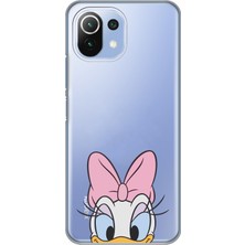 Mobilpad Xiaomi Mi 11 Lite Uyumlu Baskılı Yumuşak Silikon Şeffaf Telefon Kılıfı