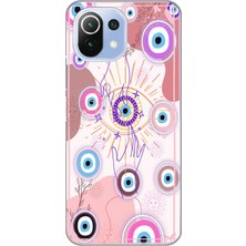 Mobilpad Xiaomi Mi 11 Lite Uyumlu Baskılı Yumuşak Silikon Şeffaf Telefon Kılıfı