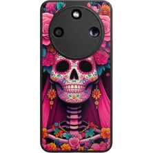 Honor Magic 8 Lite Uyumlu Kurukafa Tasarımlı Glossy Premium Kılıf