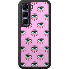Bg Aksesuar Infinix Hot 60 Pro Plus Uyumlu Göz Tasarımlı Glossy Premium Kılıf