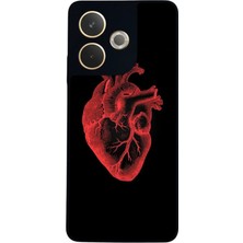 BG AKSESUAR Oppo A5 Pro Uyumlu Kalp Love Tasarımlı Glossy Premium Kılıf