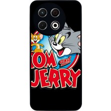 BG AKSESUAR Tecno Spark 30 Pro Uyumlu Tom And Jerry Tasarımlı Glossy Premium Kılıf