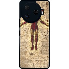 Tecno Camon 30 Pro Uyumlu  Iron Man ( Demir Adam ) Tasarımlı Glossy Premium Kılıf