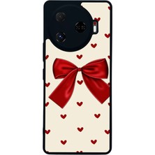 Tecno Camon 30 Pro Uyumlu Kurdele Tasarımlı Glossy Premium Kılıf