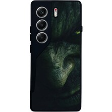 BG AKSESUAR Tecno Camon 40 Uyumlu Hulk Tasarımlı Glossy Premium Kılıf