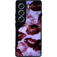 BG AKSESUAR Tecno Camon 40 Uyumlu Dudak Tasarımlı Glossy Premium Kılıf