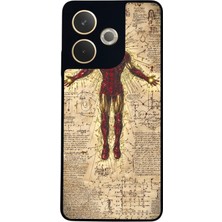 BG AKSESUAR Oppo A5 Pro Uyumlu Iron Man ( Demir Adam ) Tasarımlı Glossy Premium Kılıf