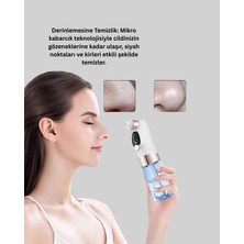 VeraGlobe Buğz Elektrikli Siyah Nokta Cihazı - Buğz