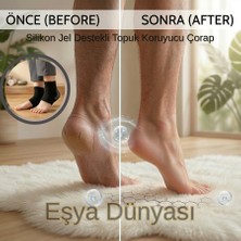 Eşya Dünyası Spa Etkili Nemlendirici Silikon Topuk Çorabı - Topuk Çatlak Giderici ve Koruyucu (1 Çift)