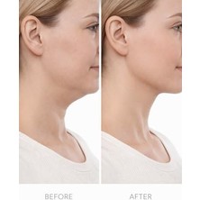 Nacario Lenfatik Drenaj Fırçası Yüz & Vücut Masaj Kuru Fırça Lenfatik Akış Stimülatörü Şişlik Azaltıcı Selülit Masaj Aracı Cilt Arındırıcı Şekillendirici Ergonomik Tasarım