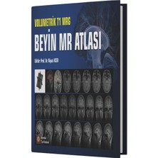 Volumetrik T1 Mrg Beyin Mr Atlası