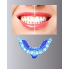 VeraGlobe Buğz Beyazlatma Kalemli LED Diş Parlatma Seti - Buğz