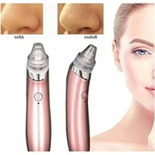 Esranın Dünyası Vakumlu Siyah Nokta Temizleme Cihazı - Derinlemesine Cilt Bakımı