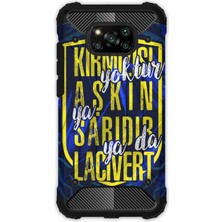 Egstech Xiaomi Poco X3 Nfc - X3 Pro Kılıf Army Tank Full Koruma Antishock - Aşkın Rengi Sarı Lacivert