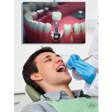 Şehber Tekli, Yatay, Kanvas, Dekoratif, Duvar, Tablosu , Ağız Diş Sağlığı, Dişçi, Implant