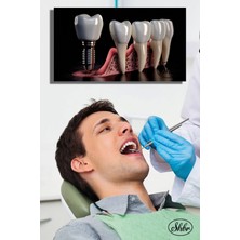 Şehber Tekli, Yatay, Kanvas, Dekoratif, Duvar, Tablosu , Ağız Sağlığı, Dişçi, Poliklinik, Hastane,