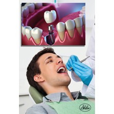 Şehber Tekli, Yatay, Kanvas, Dekoratif, Duvar, Tablosu , Ağız Sağlığı, Dişçi, Poliklinik, Hastane,