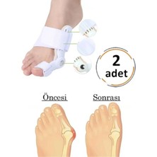 Sihirlicin 2\\\\\\\'li Atel Ayak Parmak Başparmak Düzeltici Kemik Çıkığı Düzleştirici Taraklı Ayaklar Için Aparat
