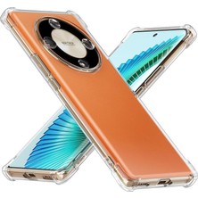 Kzy Honor X9B ile Uyumlu Kapak Kamera Korumalı Airbag Antishock Köşe Korumalı Şeffaf Silikon Kılıf