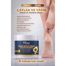 Blue Skin Care Ayak Tırnak Mantar Bakım - Topuk Çatlak.onarıcı Beyazlatıcı Etkili Krem 150 ml