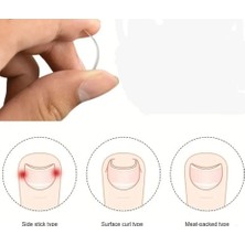 Toyigoo Ieg™ Batık Tırnak Düzeltici Aparat