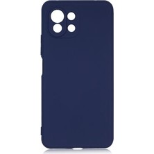 Moby Shop Xiaomi Mi 11 Lite Yumuşak Doku & Kadife Iç Kaplama – Esnek Silikon Koruyucu Kılıf