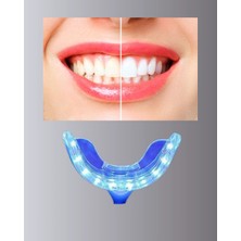 20 Dakikada Hızlı Etkili Diş Beyazlatıcı Cihaz