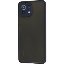 Ieg™  Xiaomi Mi 11 Lite Kılıf Montreal Silikon Kapak - Lacivert