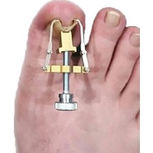 Nexgen Batık Tırnak Düzeltme Aleti