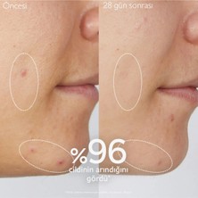 Caudalie Vinopure Akne Karşıtı Arındırıcı Temizleme Jeli 150 ml Akne Eğilimli Ciltler İçin A Vitamini