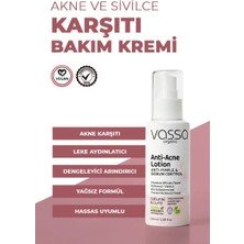 Vassa Akne, Sivilce ve Leke Karşıtı Onarıcı Bakım Kremi – Akne ve Sivilce Karşıtı Krem 100 ml