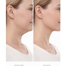 TeknoKapsül Lenfatik Drenaj Fırçası Yüz & Vücut Masaj Kuru Fırça Lenfatik Akış Stimülatörü Şişlik Azaltıcı Selülit Masaj Aracı Cilt Arındırıcı Şekillendirici Ergonomik Tasarım